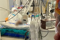 Coronavirus, solo 8 in terapia intensiva in Puglia