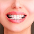 L'ortodonzia è importante su tutto il corpo