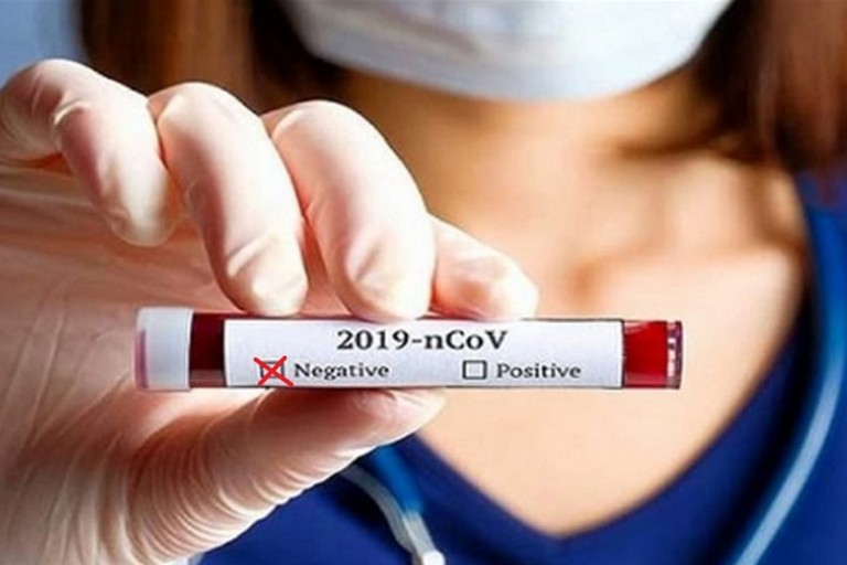 Negativo Coronavirus