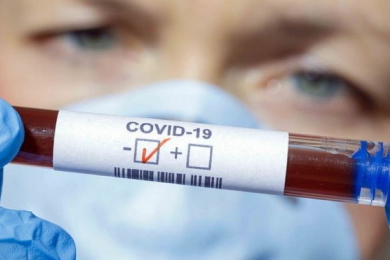 Test Coronavirus